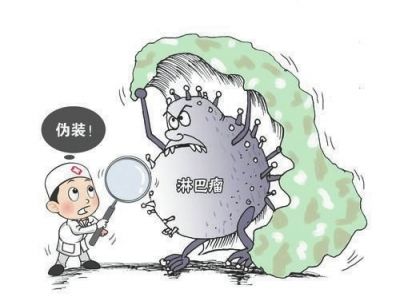 淋巴瘤的预防方法